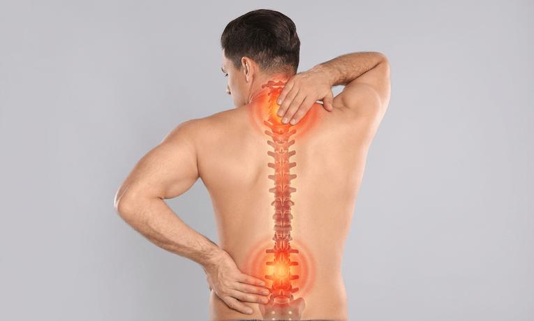 záda muže s vyznačenou páteří a bolestivými místy